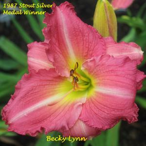 Becky Lynn - 1987 Stout Silver Medal Winner